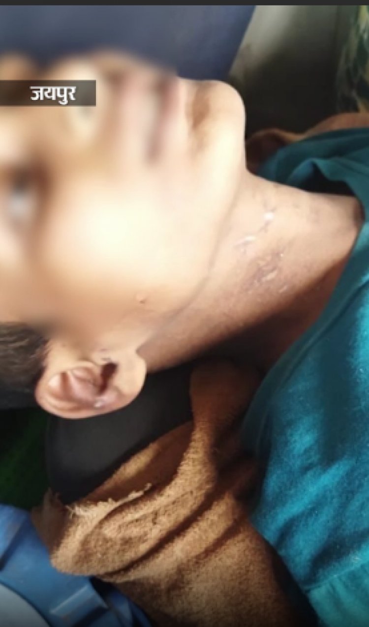 12 साल के बच्चे से हैवानियत, चाकू से काटे तलवे:पत्नी के सामने पति करता रहा नाबालिग से कुकर्म, रेंगता हुआ सड़क पर पहुंचा पीड़ित