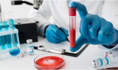 एनीमिया रोगियों के लिए बेहद फायदेमंद हैं ये चार चीजें — आज से ही डाइट में करें शामिल